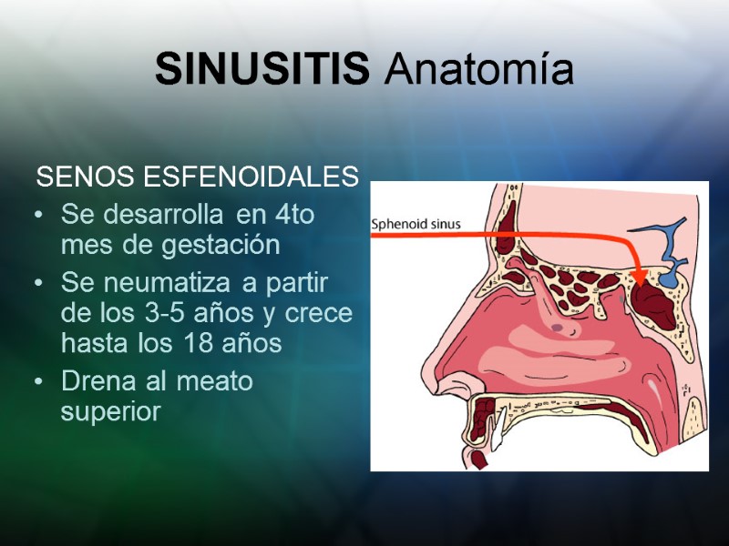 SINUSITIS Anatomía SENOS ESFENOIDALES Se desarrolla en 4to mes de gestación  Se neumatiza